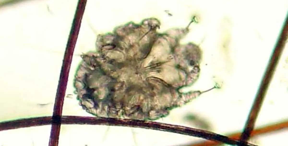 Canine_scabies_mite