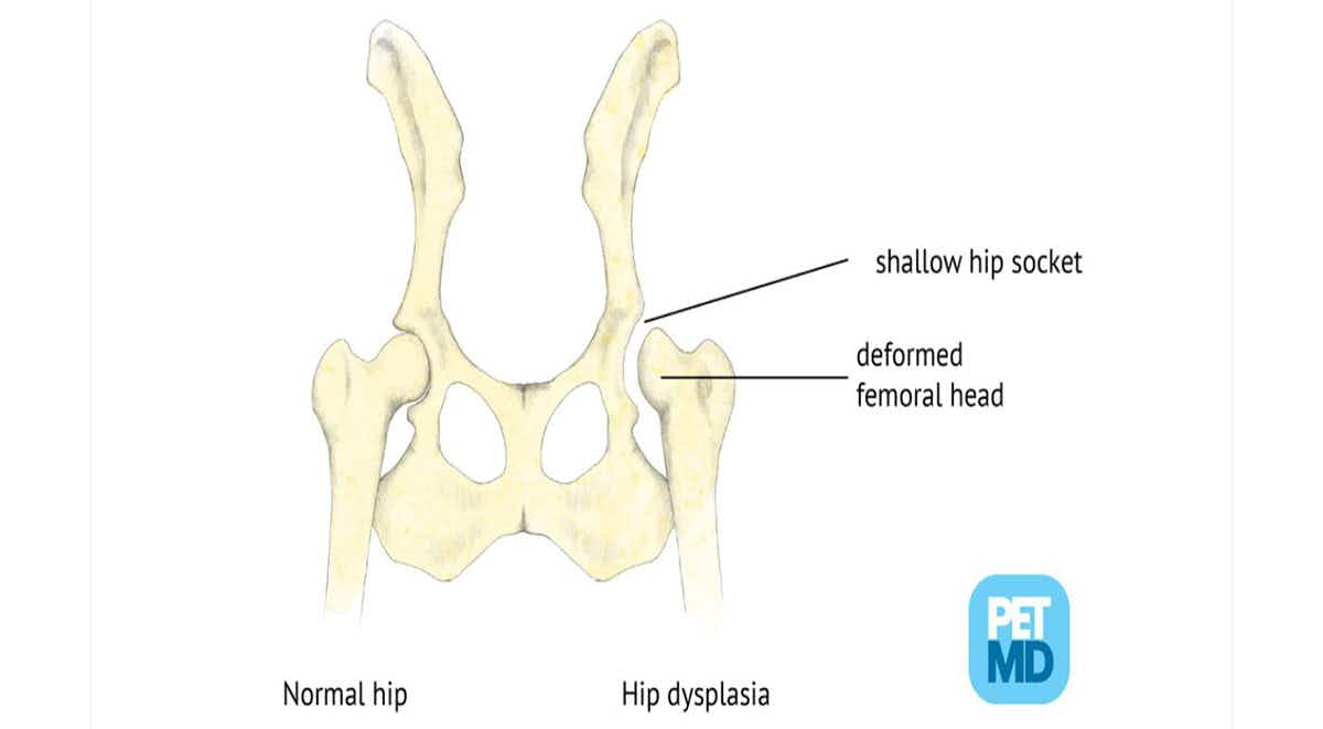 Hip dysplasia