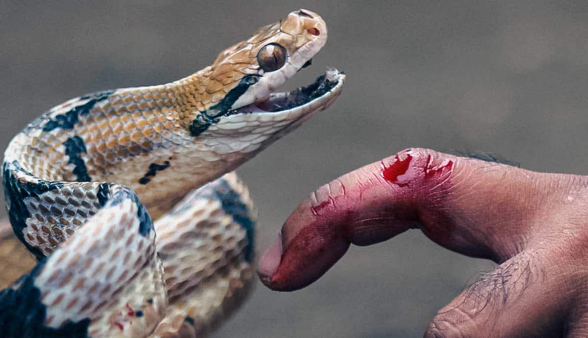 4 Steps to Take if You Get Bitten by a Snake