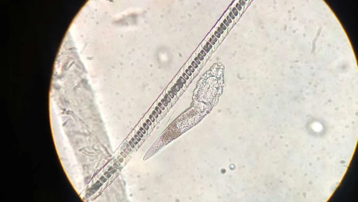 microscopic parasites