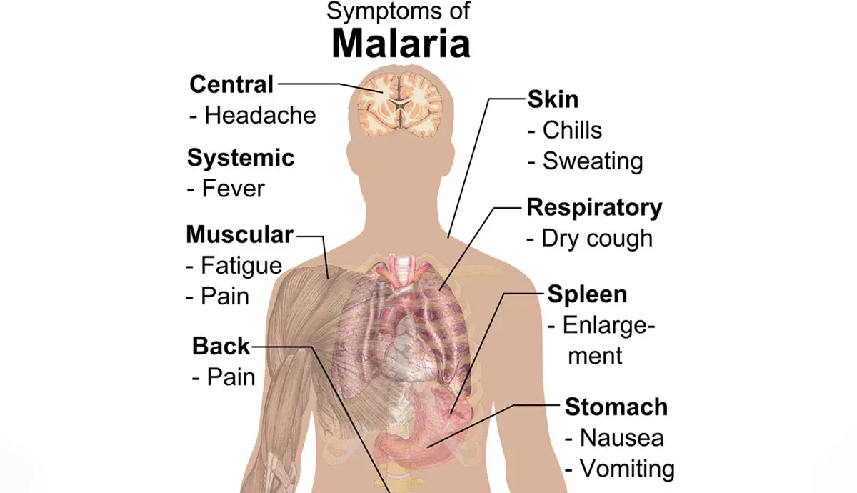 symptoms of malaria diagram